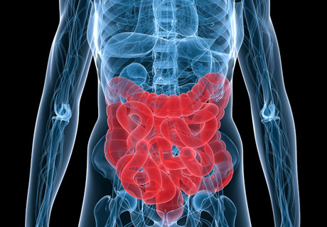 یک توصیه مهم برای پیشگیری از سرطان روده بزرگ