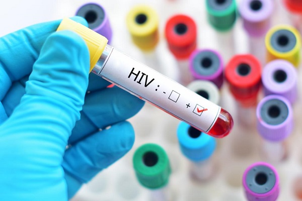 جمعیت پنهان مبتلایان HIV در روستاها