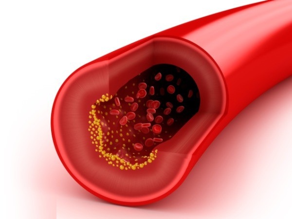 راهکاری برای کاهش چربی خون