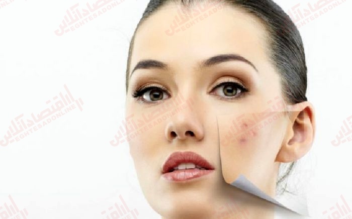 طبق نظریه علمی لکه‌ های روی پوست شما به چه معناست؟