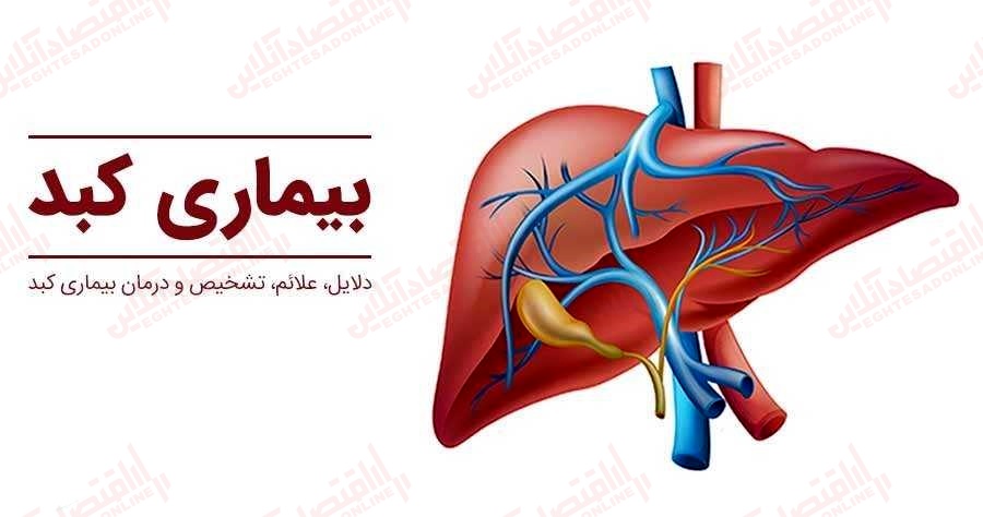 بیماری‌ های کبد؛ علائم وعوارض آن