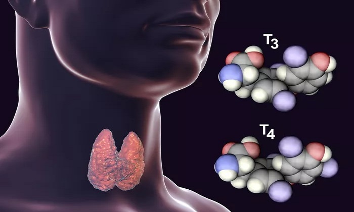 آنچه باید درباره کم کاری تیروئید بدانیم