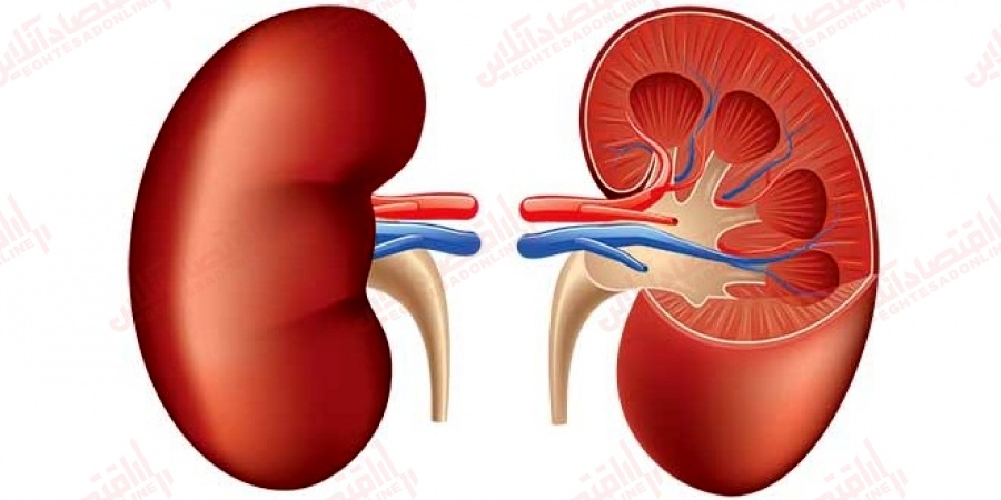 توصیه هایی برای سالم ماندن کلیه ها