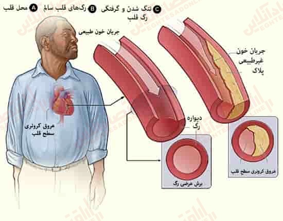 همه آنچه می‌ خواهید در مورد پروستاگلاندین‌ ها بدانید