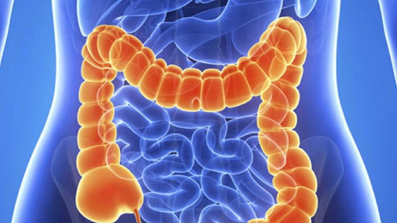 سرطان مرگبار روده بزرگ را با این علایم بشناسیم!
