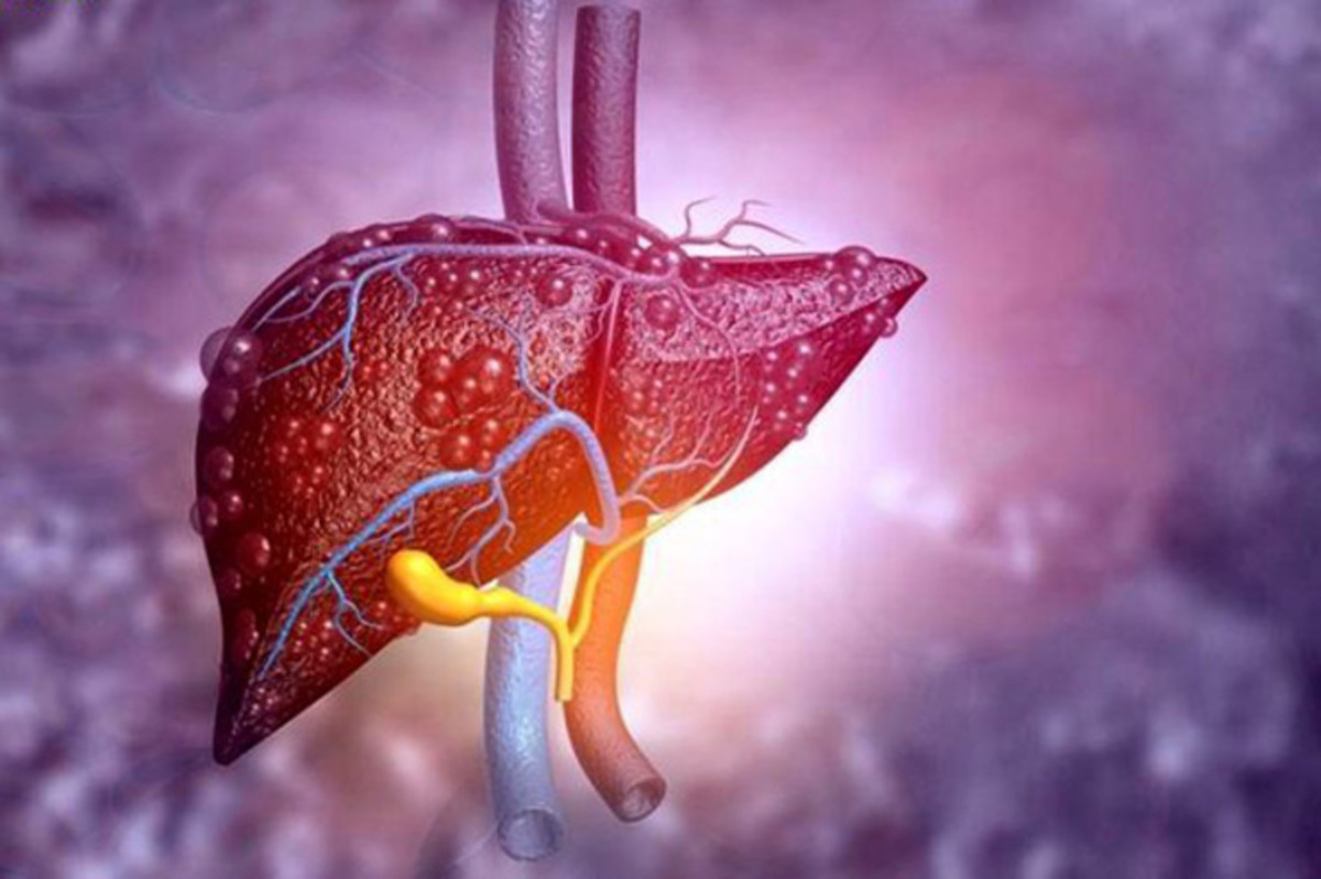 قاتلان اصلی کبد را بشناسید!