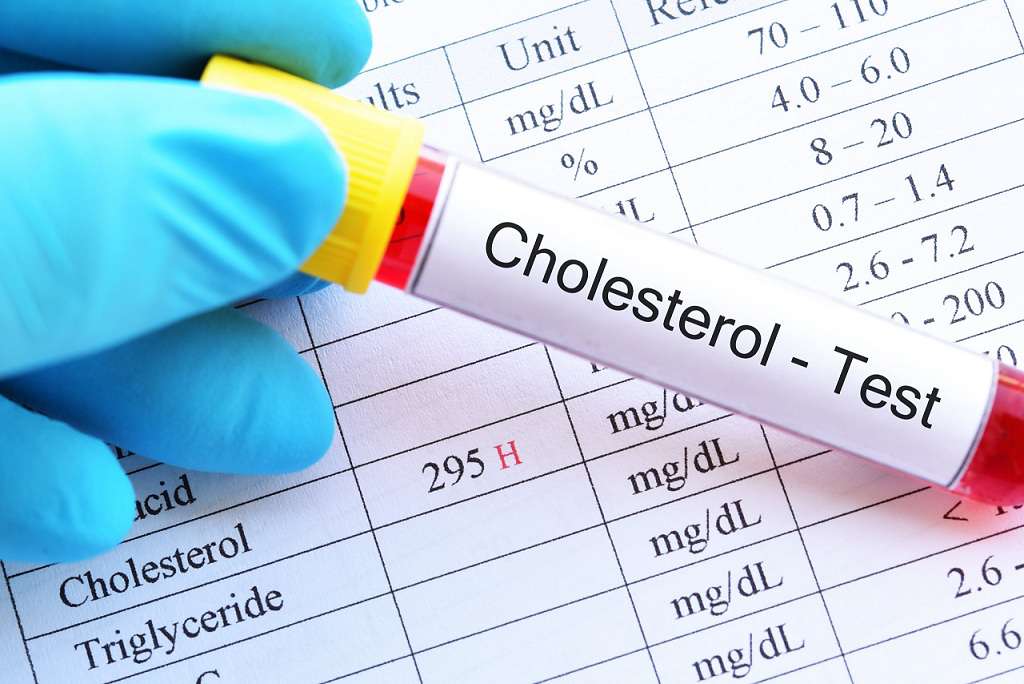 چگونه متوجه شویم کلسترول خون ما بالاست؟ + عوارض، درمان و پیشگیری