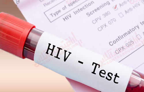 آخرین وضعیت شیوع HIV در ایران