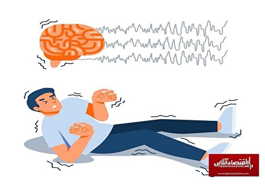 بیماری صرع و روش‌های درمان را بهتر بشناسیم