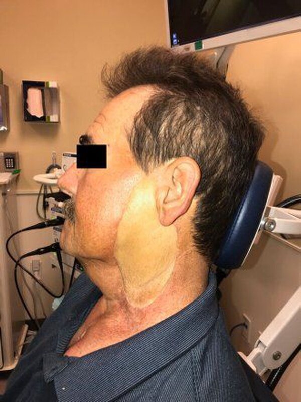 اگر مسواک نزنید به این نوع سرطان مبتلا میشوید اگر مسواک نزنید به این نوع سرطان مبتلا میشوید