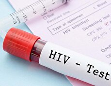 واکنش مقام وزارت بهداشت به محرمانه بودن اطلاعات تست HIV