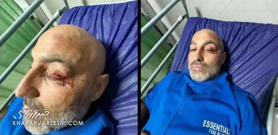 تصادف خطرناک چهره مشهور کشور / رامین محرمنژاد راهی بیمارستان شد تصادف خطرناک چهره مشهور کشور / رامین محرمنژاد راهی بیمارستان شد